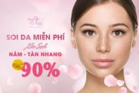 Soi da miễn phí, xóa sạch nám, tàn nhang hiệu quả đến 90%